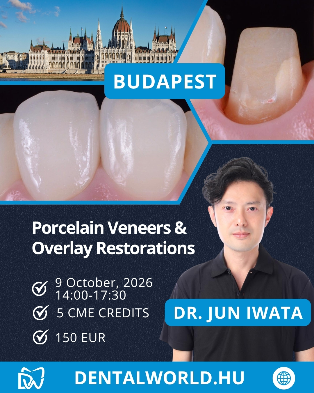WORKSHOP: Porcelain Veneers and Overlay Restorations – Preparation and Workflow