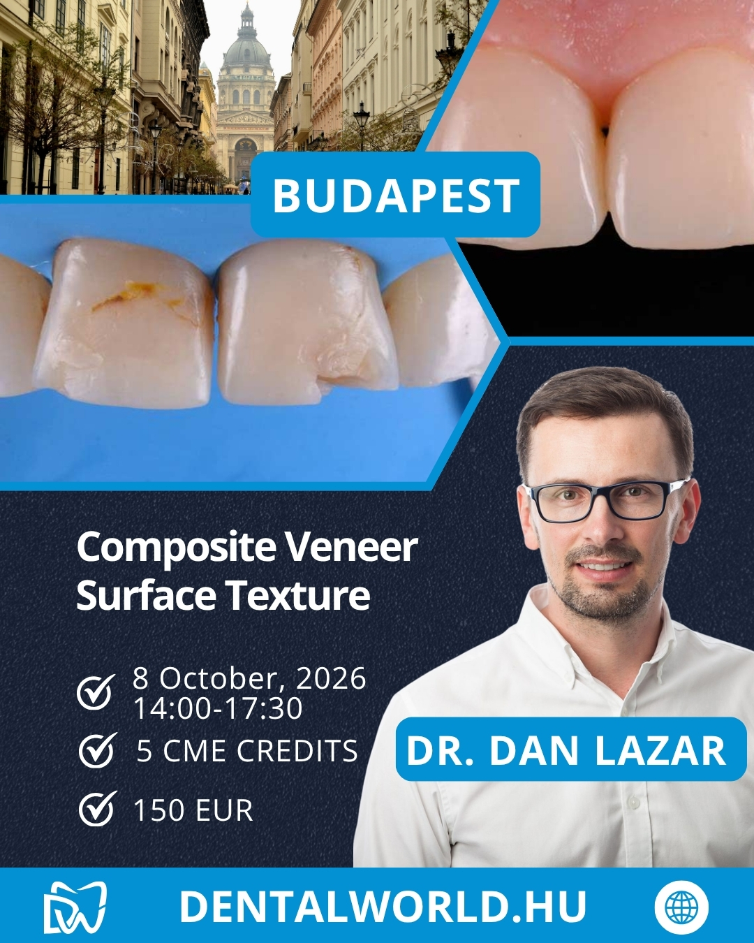 WORKSHOP: Composite Veneer Surface Texture – Step by Step