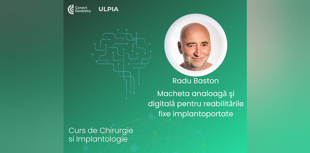 Macheta analoagǎ şi digitalǎ pentru reabilitǎrile fixe implantoportate