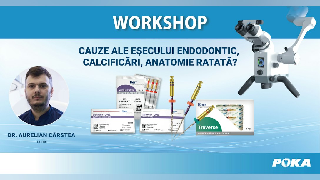 Cauze ale esecului endodontic, calcificari, anatomie ratata?