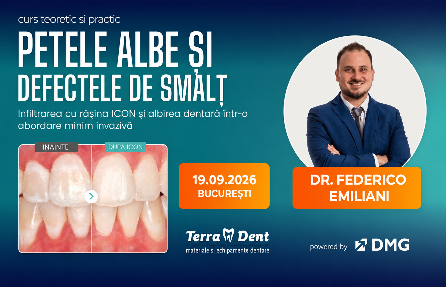 Petele albe si defectele de smalt: de la diagnostic la tratament - SOLD OUT