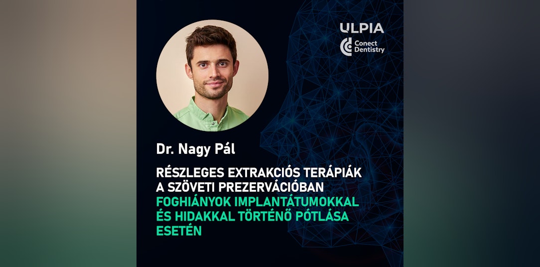 Részleges extrakciós terápiák a szöveti prezervációban foghiányok implantátumokkal és hidakkal történő pótlása esetén